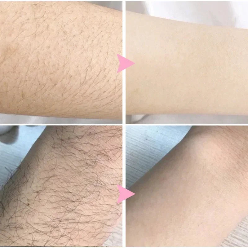 Hair Removal Cream Semi-permanent Painless Hair Remove Woman Men Body Underarm Depilatory Cream Effective Inhibition Hair Growth